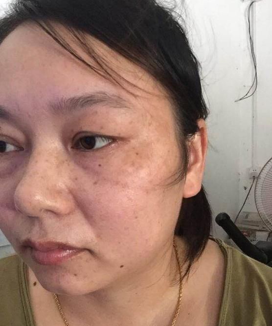 开塞露也可以补水祛斑？阿姨每天用它抹抹脸，皮肤水嫩白里透红