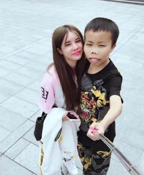 还记得“外星人”陈山吗？封杀3年变化巨大，网