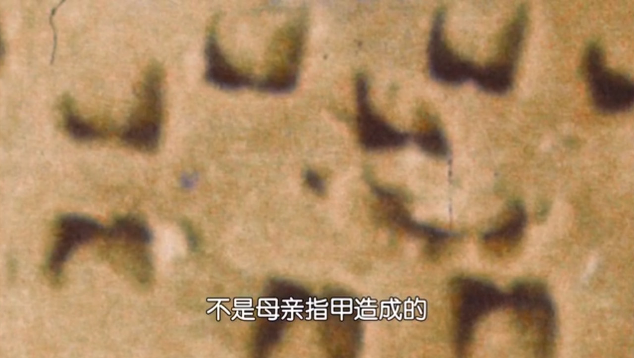 这部全是神反转奇案的解剖纪录片，堪称法医入坑神作