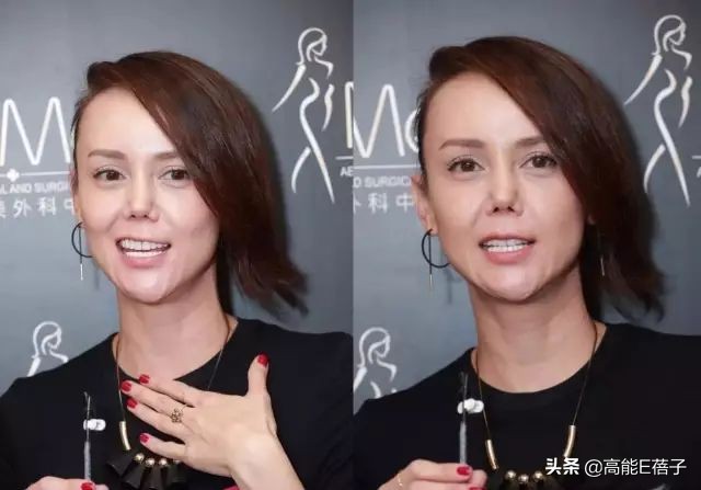 45岁亚姐冠军宣布破产！为医患癌母欠下巨债，一