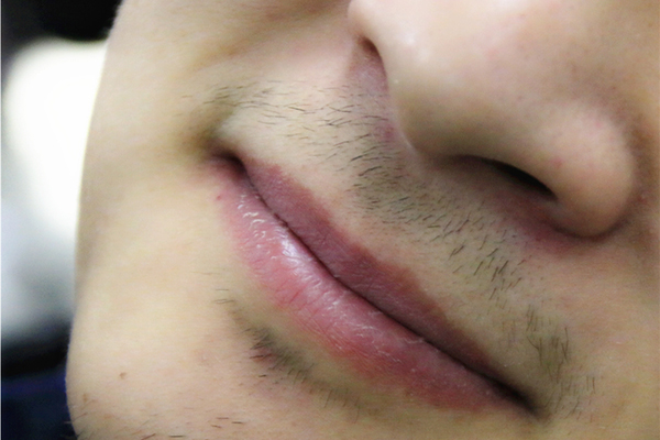 男性刮胡子次数多，说明了什么？提醒：刮胡子频率，与寿命无关