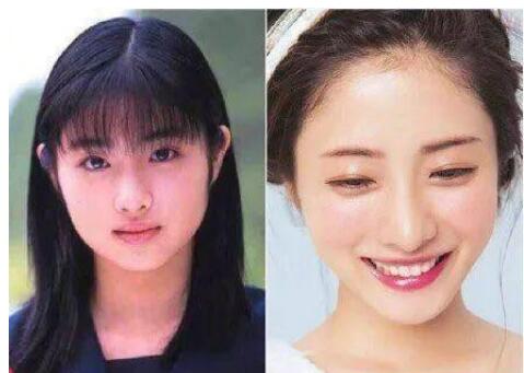 整容失敗才叫做「整容臉」，那些整容成功的明星，你根本看不出來 - 資訊咖