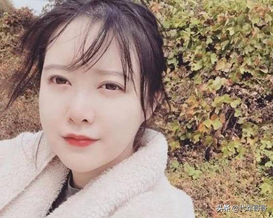 饱受脱发困扰的美女明星，郑爽第八，杨幂第二，鞠婧祎排第几？