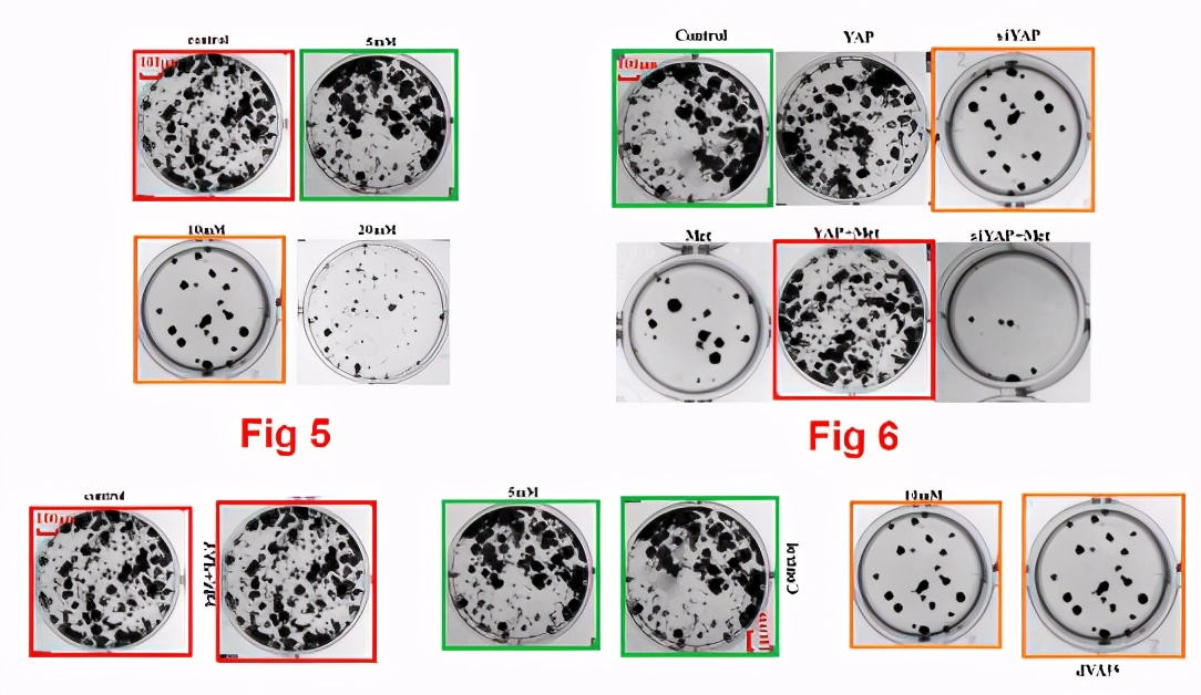 山东滨州医学院附属医院11篇SCI文章"挂榜"PubPeer