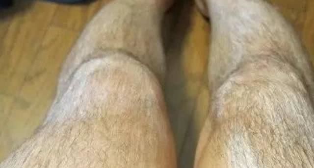 为什么有的男生腿毛浓密，有的却光秃秃的？医