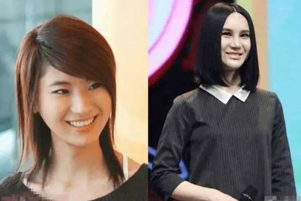 整容失败的10位明星，谁堪称“阴影”之最？