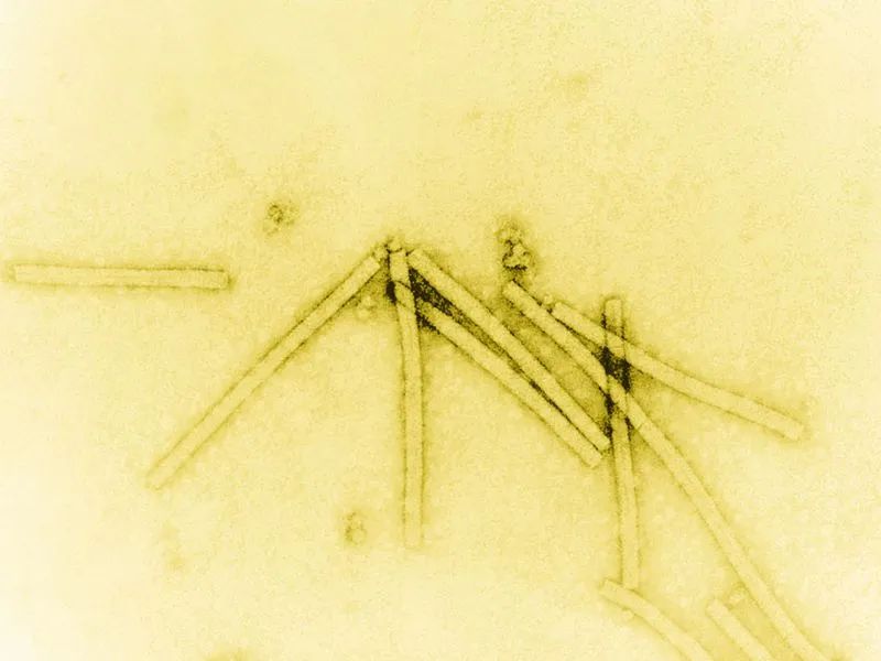 麵對致死率最高的傳染病，這個男孩幸存了下來