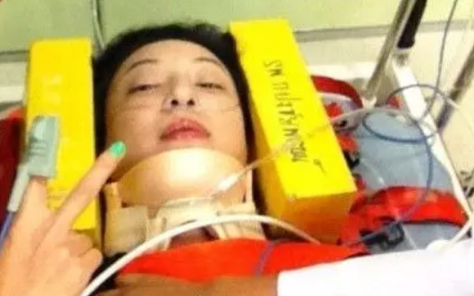 郑希怡回忆坠楼细节，与应采儿坠下近10米，被树杈穿肺险瘫痪