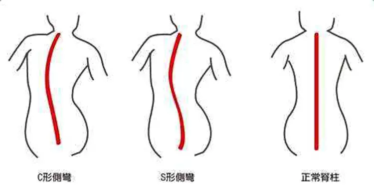 颈椎难受 该换一张苏老伯精细黄麻床垫