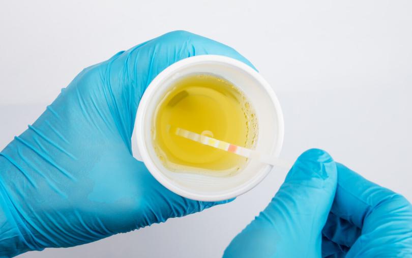 "Kexin" in high uric acid is announced, and the winter melon is only