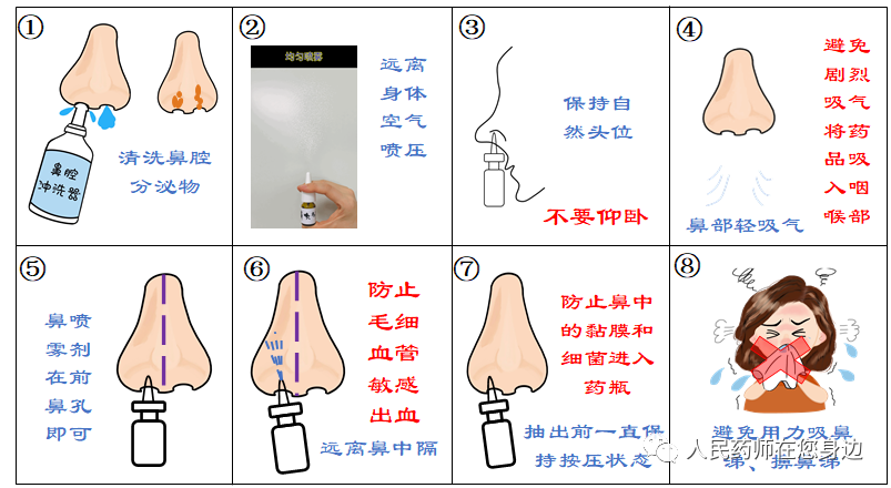 一文读懂一个药 布地奈德鼻喷雾剂 人民药师在您身边 Mdeditor
