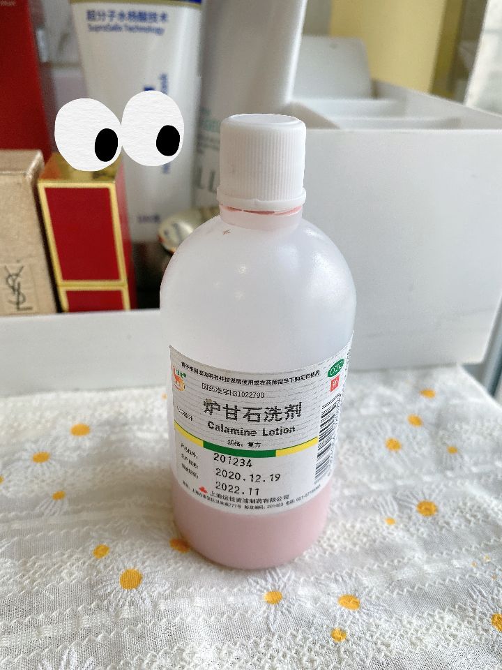 Greatly truthful!Calamine lotion for acne treatment is really 