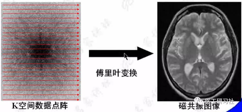 磁共振这么“吵”，我们有办法吗？