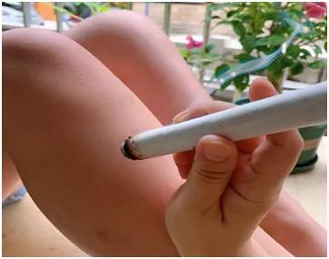 中醫艾灸真有用嗎？ 適用於哪些病症？ 醫院中醫科科普來了