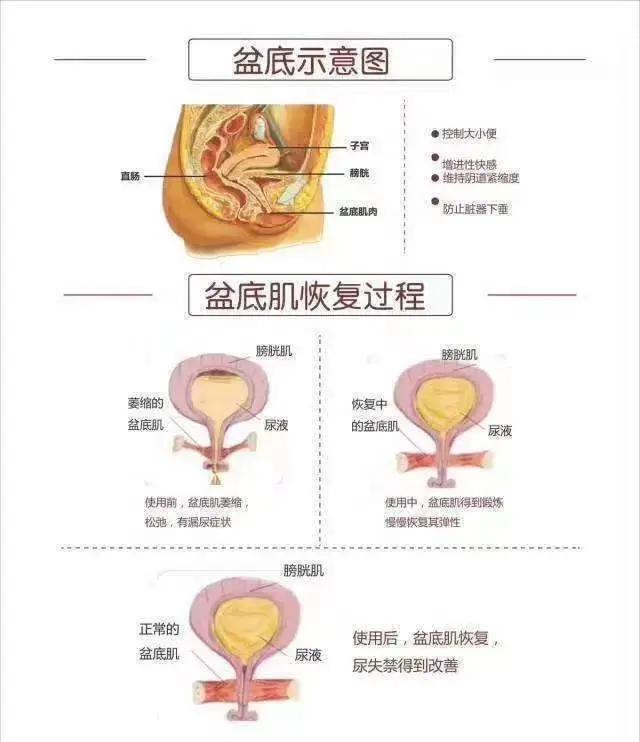 产后修复必做项目之一，做完有十大好处