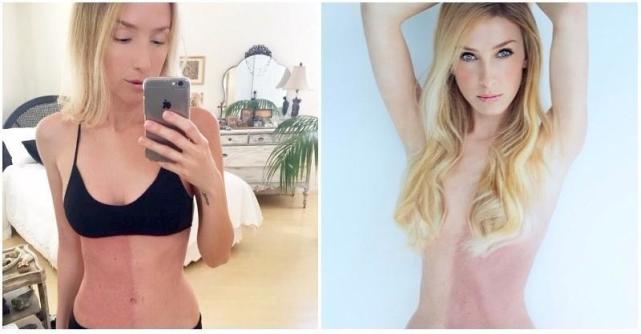 美國女星擁有兩種膚色，長大後發現，身體裏長著自己的雙胞胎姐妹