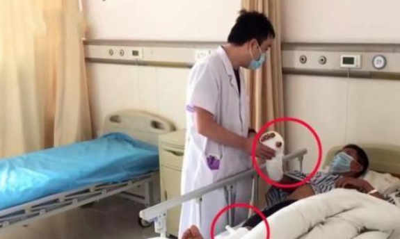 先抹|大爷烧伤后先抹盐水后抹大酱 网友：你腌肉呢？