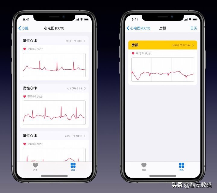 你的下一块手表，何必是手表——Apple Watch 功能体验与详解