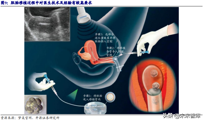 辅助生殖行业深度报告：国际化、信息化、服务化推动下的黄金赛道