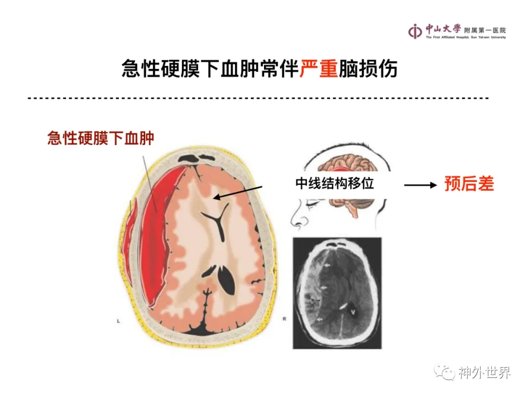 最全影像总结 | 颅内病变 MR、CT 的阅片技巧，太赞了