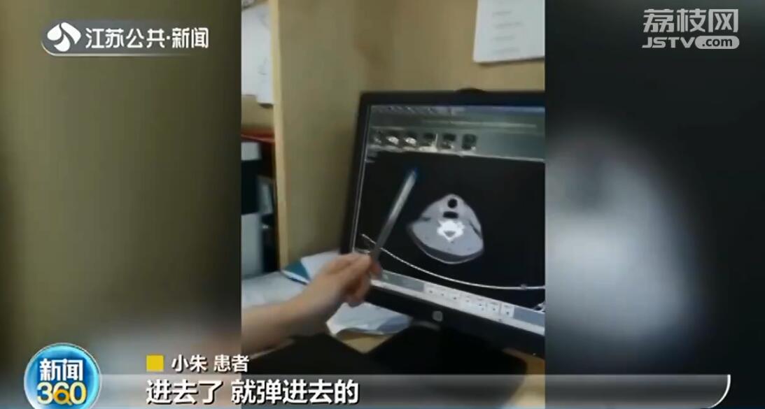 常州小伙用嘴开冰可乐 瓶盖冲进食道