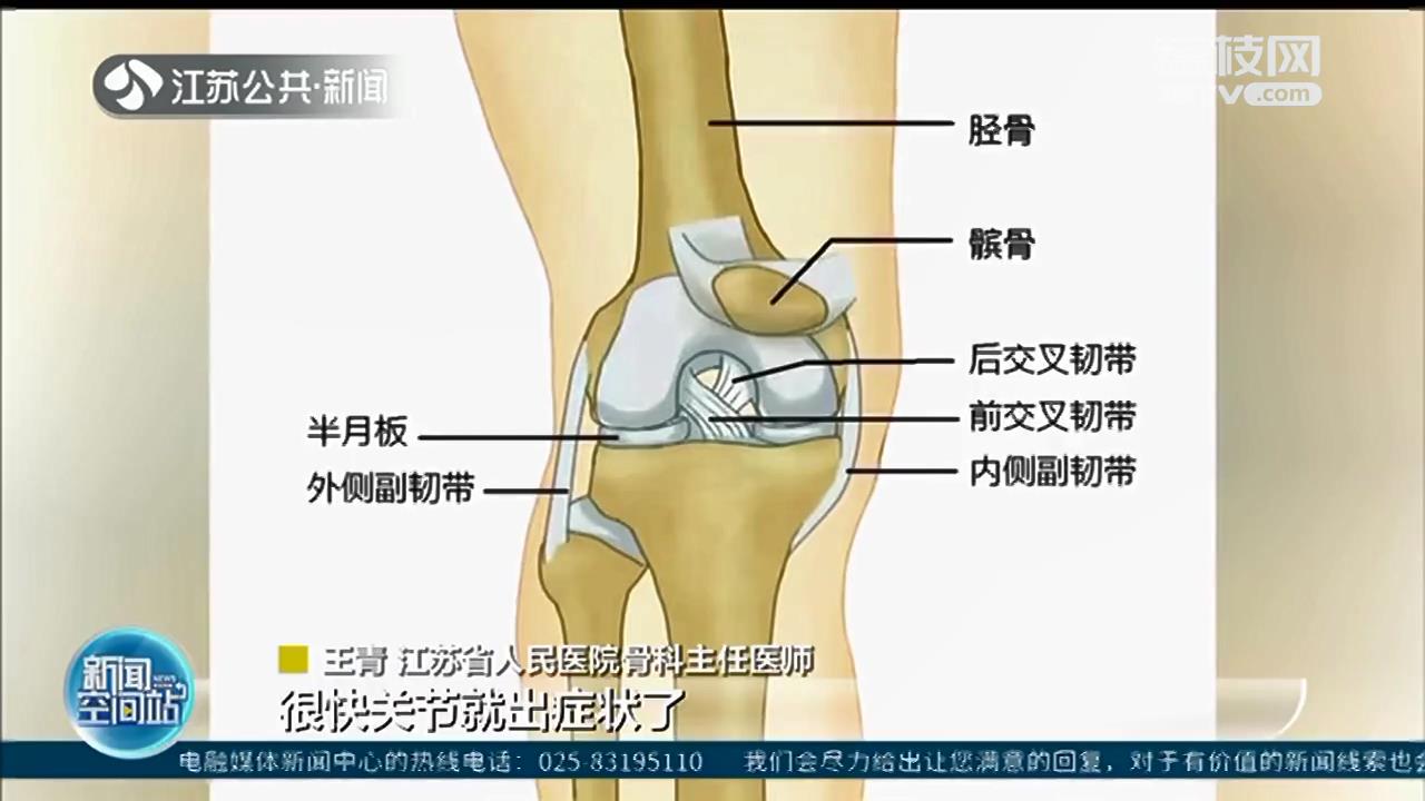 每天运动超过1万步？小心膝盖受损，关节炎发病呈年轻化趋势