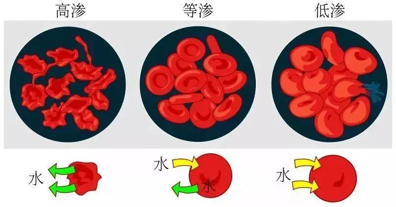 洗鼻的原理是什么？为什么不用药也能治鼻炎