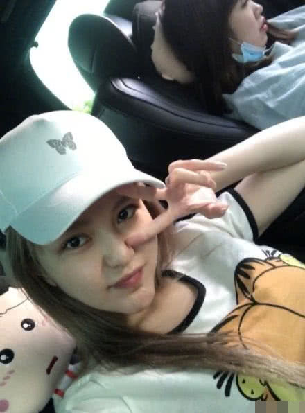 周扬青素颜照太实在，下巴针眼疤痕明显，眼睛全脸最好看