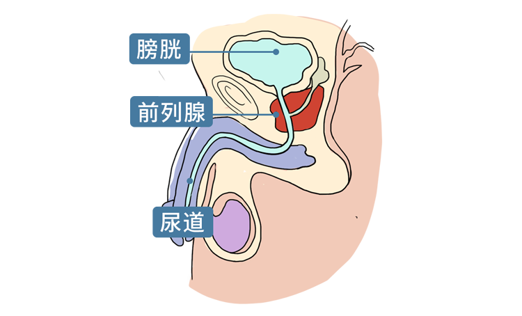 常做提肛运动让肛门有规律地收缩相当于对前列腺有效而温柔地"按摩"能