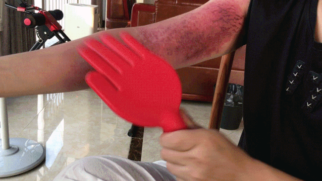 血管裡有垃圾，定期輸液通血管？ 醫生：這些做法坑你沒商量�