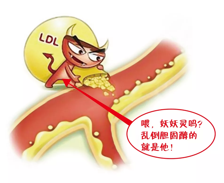 一分钟教您看懂血脂化验单,搞懂四个数据最关键