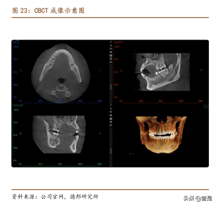 美亚光电专题研究：疫情消退CBCT恢复快速增长，新品拓展值得期待