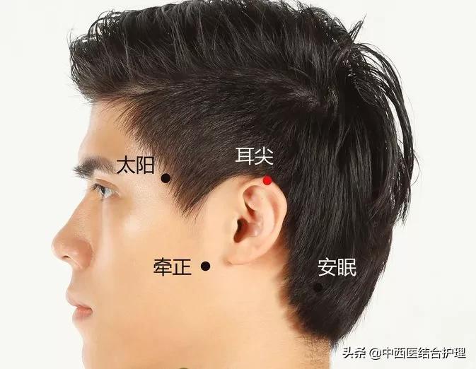 How much do you know about the magical eartip bleeding therapy of "ear