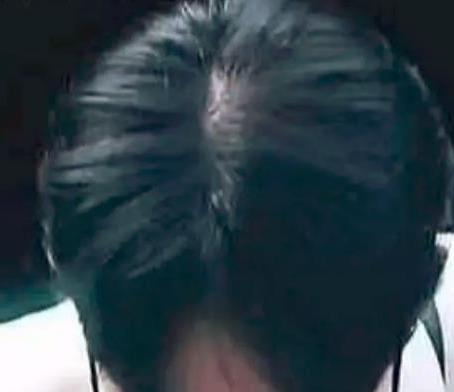 肖戰(zhàn)全面復(fù)工錄制新綜藝，恢復(fù)正軌未來(lái)可期，脫發(fā)嚴(yán)重惹粉絲心疼