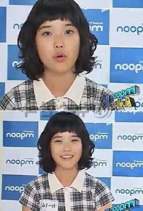 iu plastic surgery before and after
