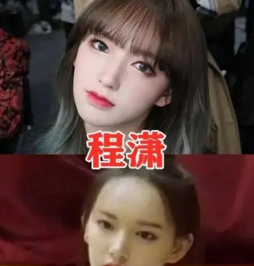 有种反差叫“掀开刘海”，杨幂发际线后移，看