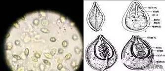如何解决对虾肝肠孢子虫 南美白对虾孢子虫怎么治疗