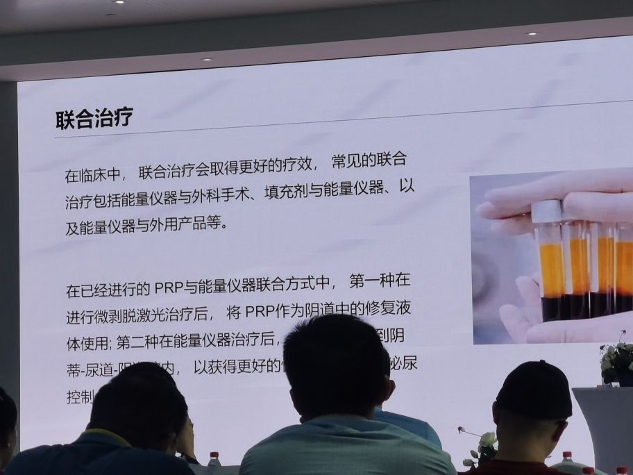 Laser treatment and plastic surgery for women's intimate rejuvenation