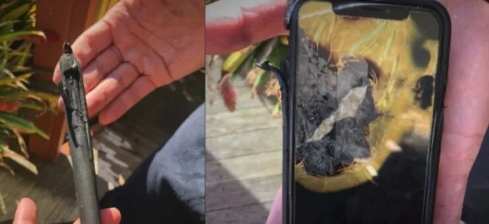 Iphone充电起火 女子脸部被烧伤 Mp头条