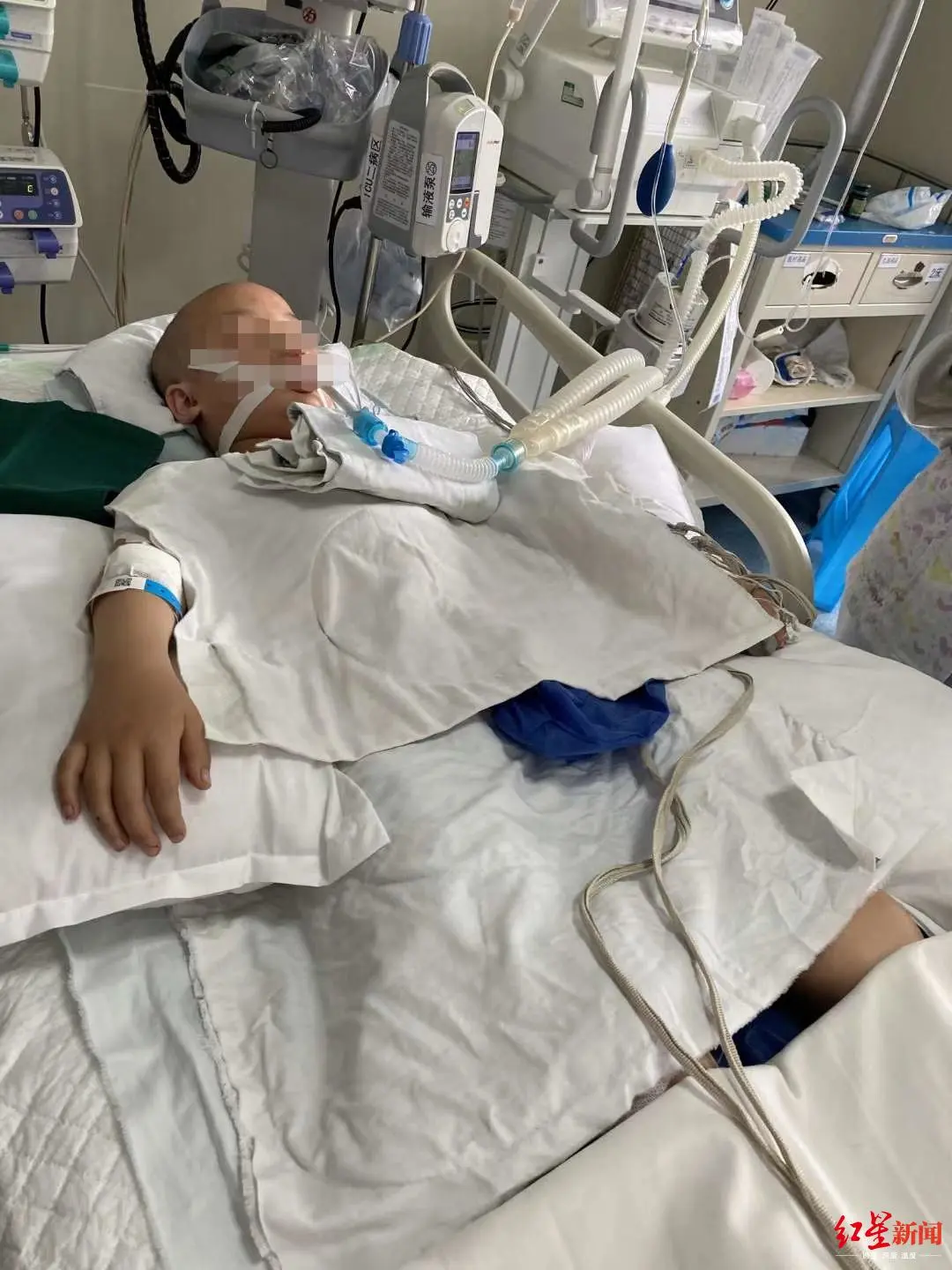 让人心痛!继父连砍4刀，女孩面临高位截瘫：孩子