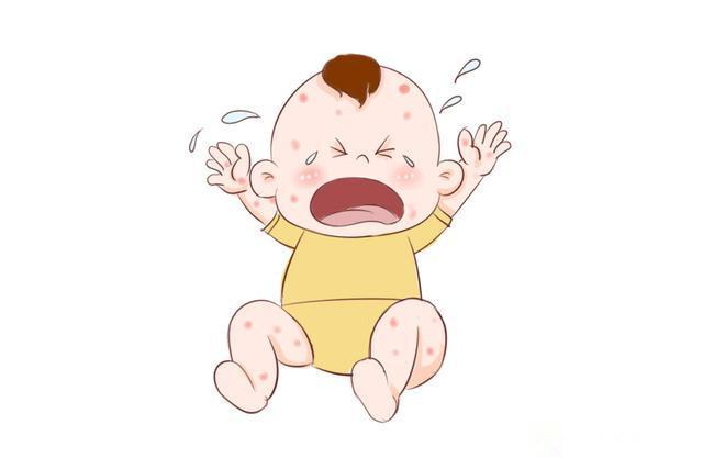 宝宝脸上常出现的小红点是什么？教你快速分辨8种红疹症状