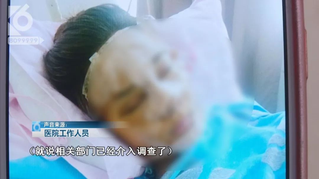 15岁少女执意整形 花11万后整容变毁容