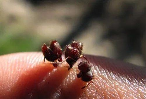 千里姻缘一线牵，盘点6000年间你不知道的那些手术缝合线 