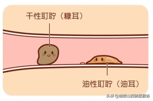 为什么耳朵很痒，却掏不出任何东西？可能是它在作怪，别忽视