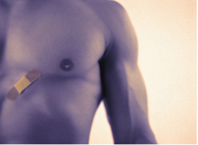 警惕！男性也会得乳腺癌，早期筛查很重要