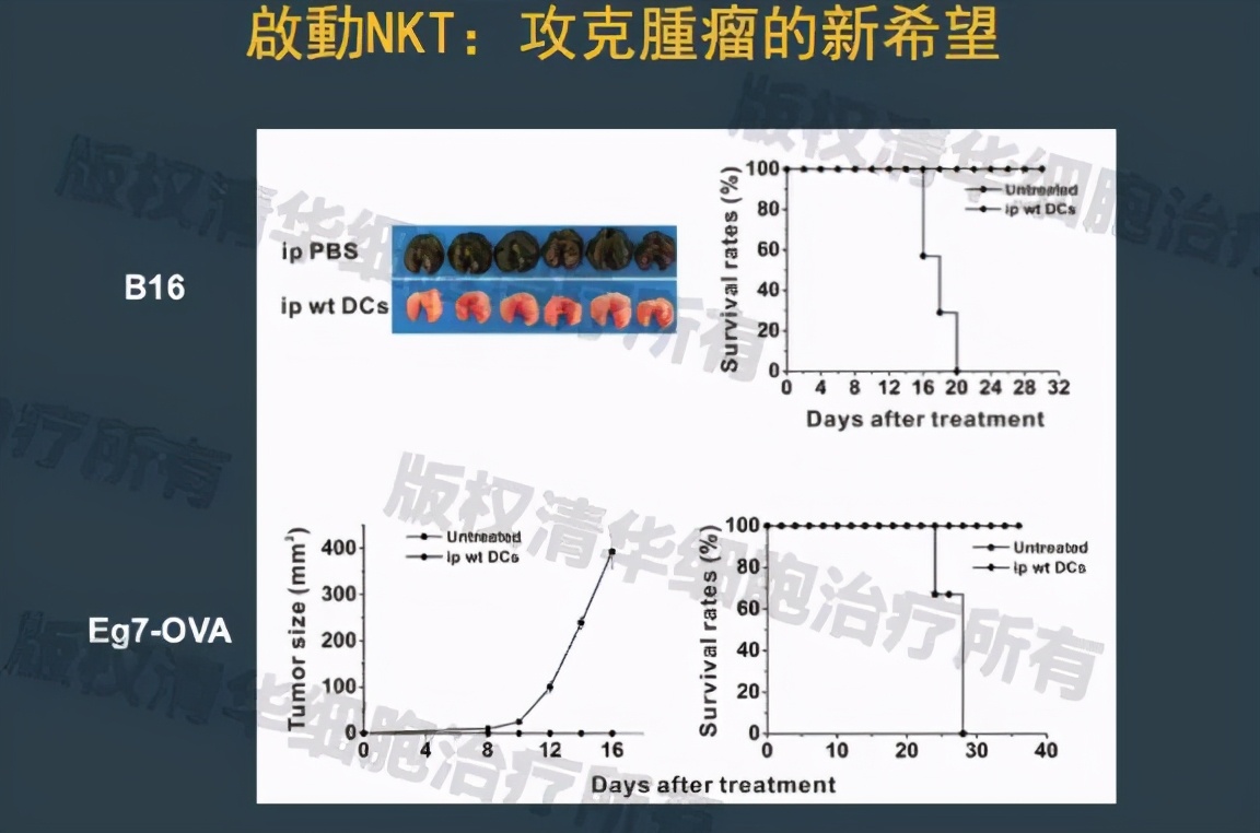 杀死癌细胞的能力，人体免疫细胞中的NKT细胞为何会如此厉害
