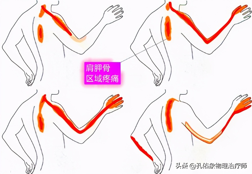 Hand numbness, pain in the shoulder blade area, what is going on?Not