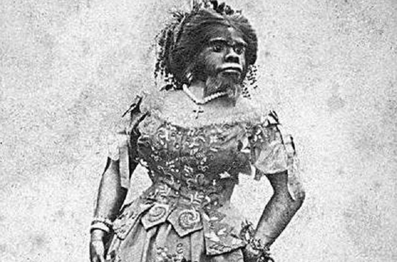 她被称为最丑女人，一生因奇特长相被当摇钱树