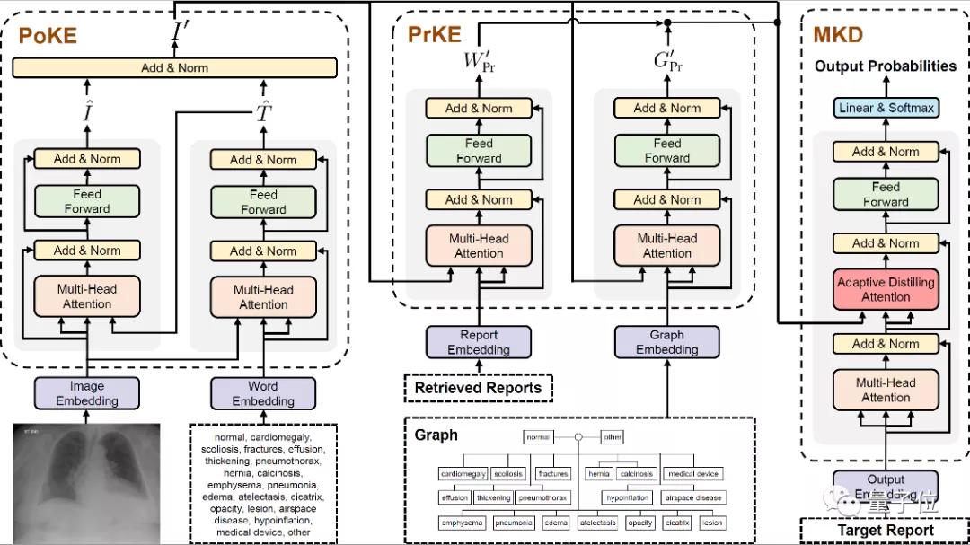 AI能写出靠谱医学报告了，CVPR2021收录｜腾讯医典出品