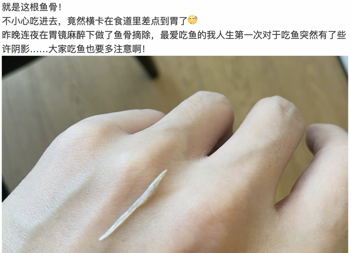 张杰深夜就医！被近3厘米鱼刺卡食道太危险，本人晒照直呼有阴影